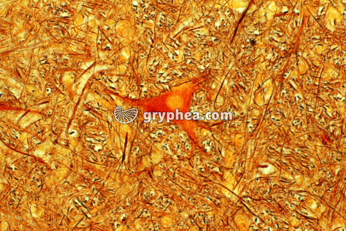 Neurone CJ x100 - gryphea.com